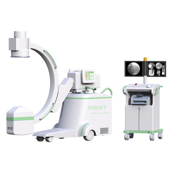 数字化医用c臂机检查效果