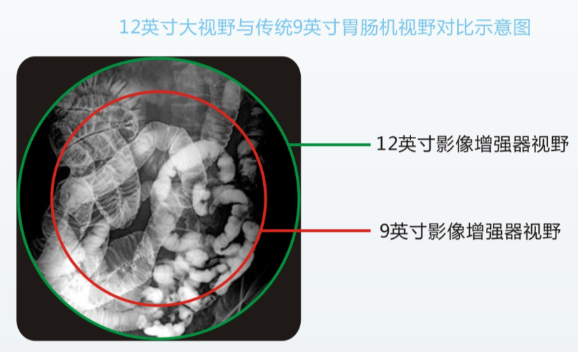 数字胃肠机优势与检查效果