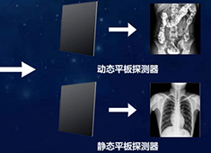 双板DR与单板DR的区别：不止是多一个平板