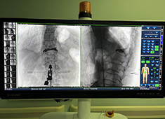 骨科手术机器人如何降低手术风险