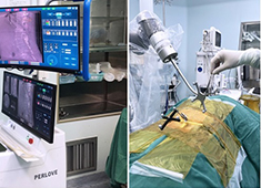 骨科手术机器人和腔镜手术机器人的区别