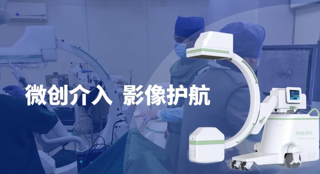 高清影像介入c臂机助力微创介入手术更成功