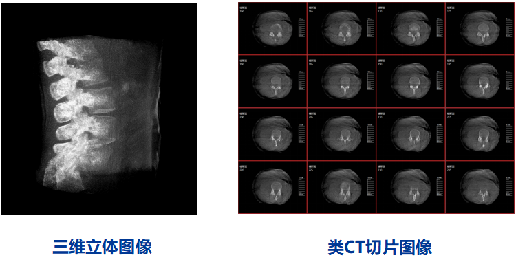 三维C型臂图像