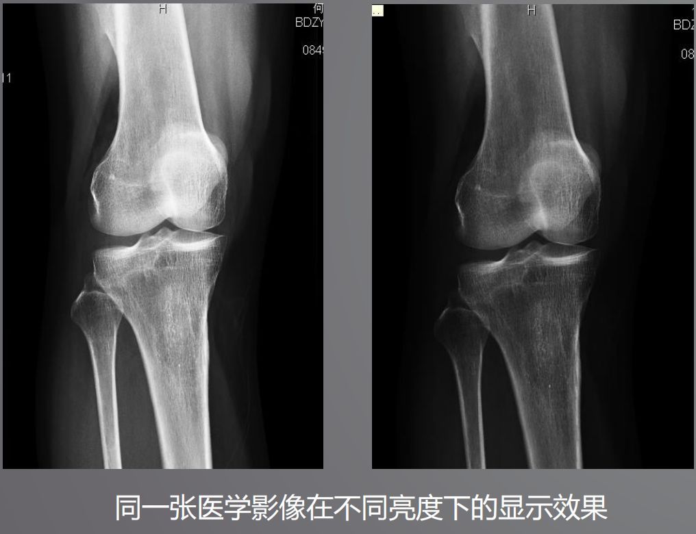 宠物DR设备的显示器有要求？普通和医用显示器有什么区别