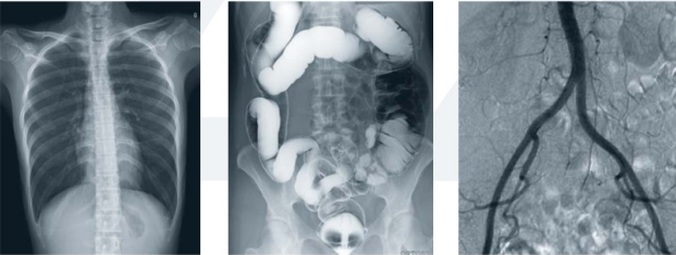 平板胃肠机临床影像