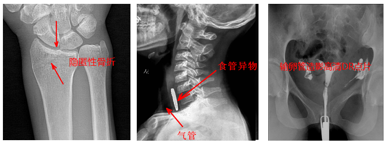 动态DR机准确点片