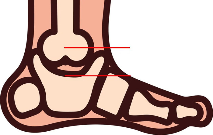 【医疗科普】三维C形臂在足踝手术中的应用
