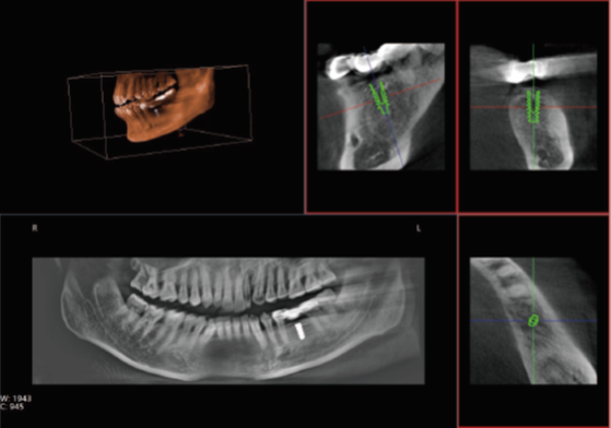 口腔CT图像