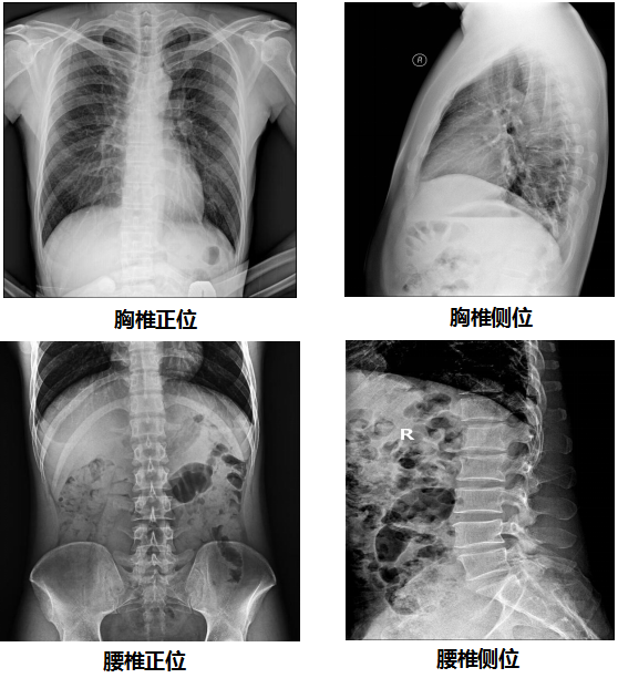 PLD7300系列双立柱DR临床图像