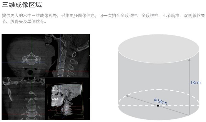 移动三维C形臂术中成像