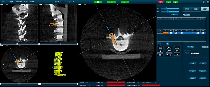 PL300B脊柱外科手术导航定位系统-操作界面