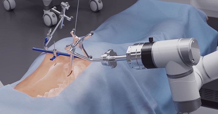 导航定位功能的骨科手术机器人PL300B